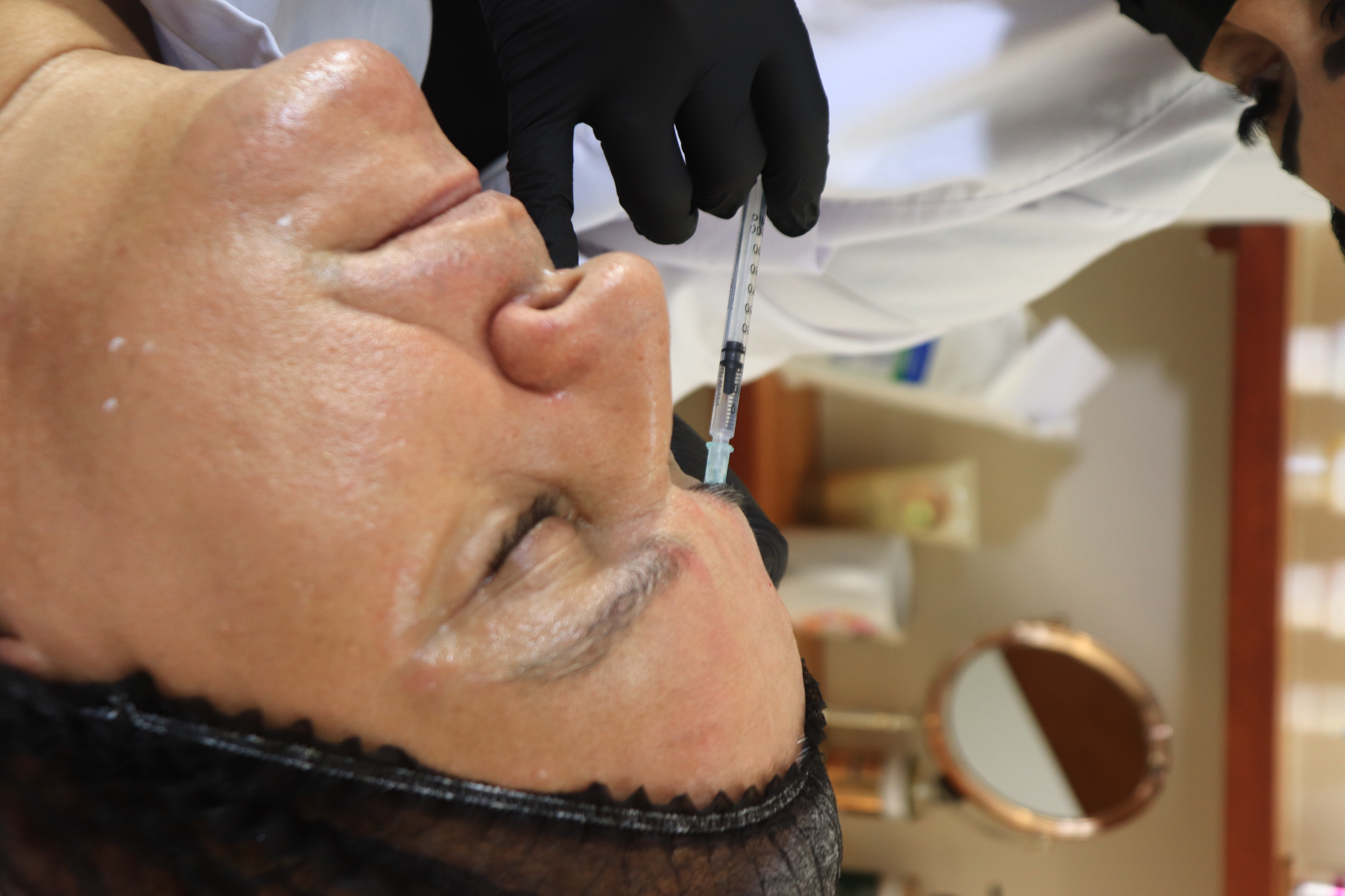 Botox application at Aura