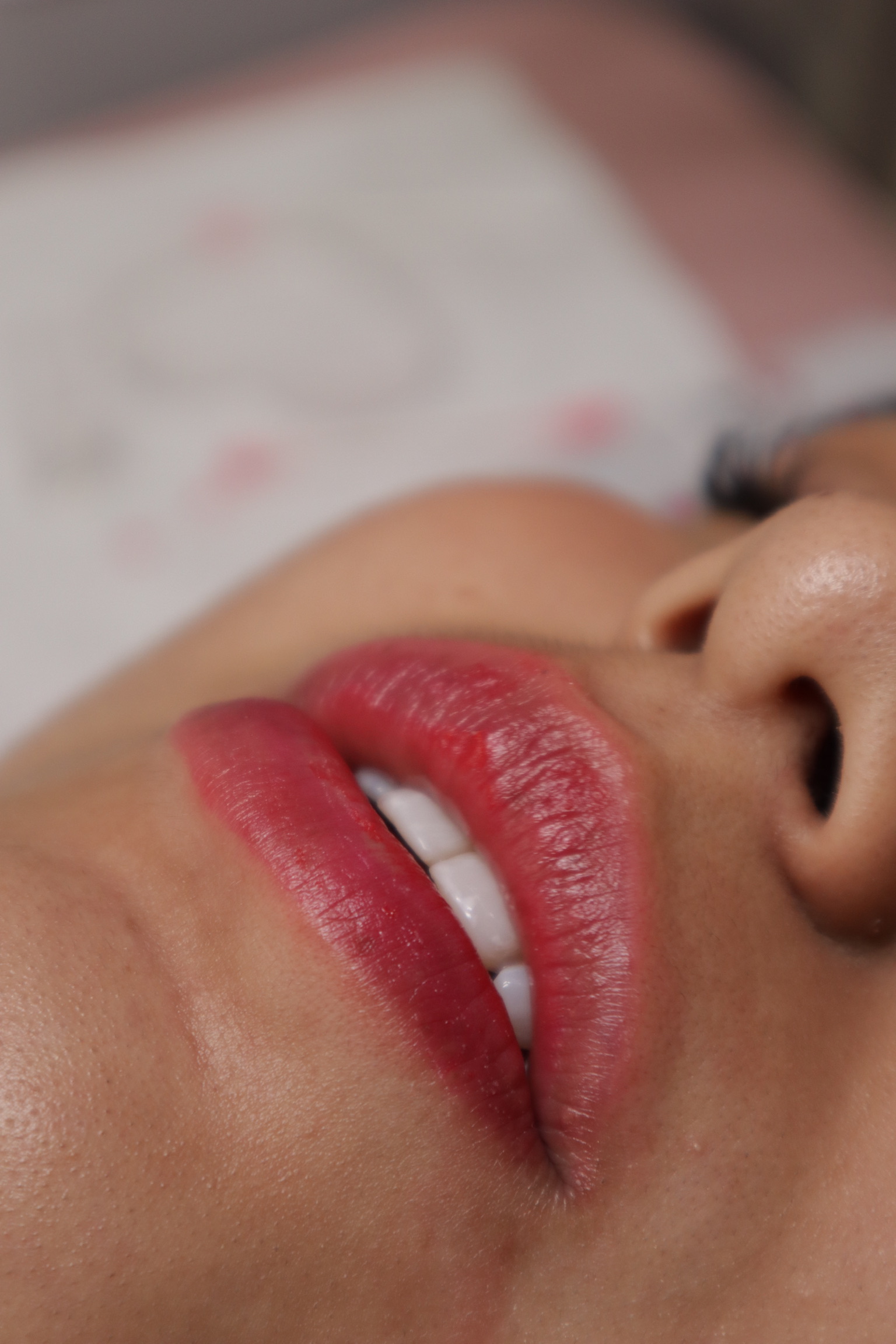 Lips